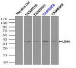 LDHA Antibody in Immunoprecipitation (IP)