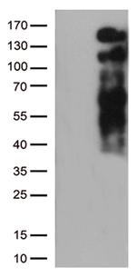 LDLR Antibody in Western Blot (WB)