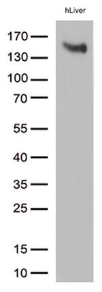 LDLR Antibody in Western Blot (WB)