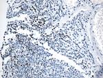 LEF1 Antibody in Immunohistochemistry (Paraffin) (IHC (P))