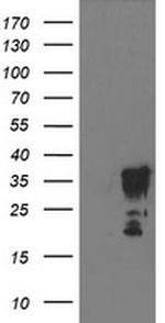 LENG1 Antibody in Western Blot (WB)