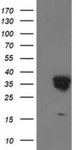 LENG1 Antibody in Western Blot (WB)