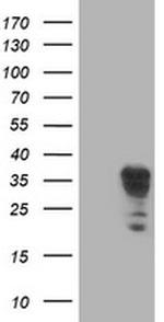 LENG1 Antibody in Western Blot (WB)