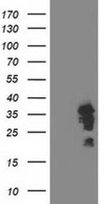 LENG1 Antibody in Western Blot (WB)