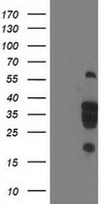 LENG1 Antibody in Western Blot (WB)