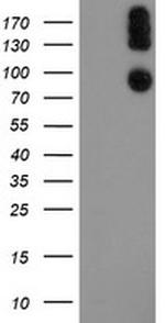 LEPRE1 Antibody in Western Blot (WB)