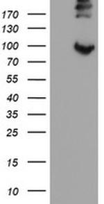 LEPRE1 Antibody in Western Blot (WB)