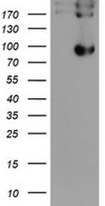 LEPRE1 Antibody in Western Blot (WB)