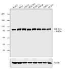 IKK beta Antibody in Western Blot (WB)