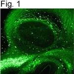 Galectin 3 Antibody in Immunohistochemistry (IHC)