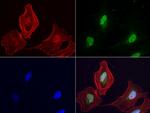 LGALS3 Antibody in Immunocytochemistry (ICC/IF)