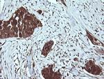 LGALS3 Antibody in Immunohistochemistry (Paraffin) (IHC (P))