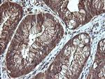 LGALS3 Antibody in Immunohistochemistry (Paraffin) (IHC (P))