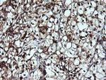 LGALS3 Antibody in Immunohistochemistry (Paraffin) (IHC (P))