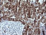 LGALS3 Antibody in Immunohistochemistry (Paraffin) (IHC (P))