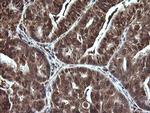 LGALS3 Antibody in Immunohistochemistry (Paraffin) (IHC (P))