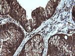 LGALS3 Antibody in Immunohistochemistry (Paraffin) (IHC (P))