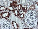 LGALS3 Antibody in Immunohistochemistry (Paraffin) (IHC (P))