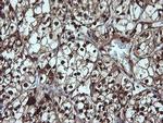 LGALS3 Antibody in Immunohistochemistry (Paraffin) (IHC (P))