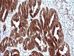 LGALS3 Antibody in Immunohistochemistry (Paraffin) (IHC (P))