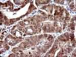 LGALS3 Antibody in Immunohistochemistry (Paraffin) (IHC (P))