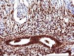 LGALS3 Antibody in Immunohistochemistry (Paraffin) (IHC (P))