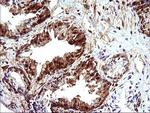 LGALS3 Antibody in Immunohistochemistry (Paraffin) (IHC (P))