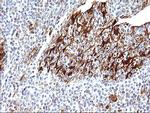 LGALS3 Antibody in Immunohistochemistry (Paraffin) (IHC (P))