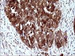 LGALS3 Antibody in Immunohistochemistry (Paraffin) (IHC (P))