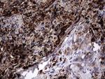 LGALS3 Antibody in Immunohistochemistry (Paraffin) (IHC (P))