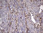 LGALS3 Antibody in Immunohistochemistry (Paraffin) (IHC (P))