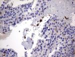 LGALS3 Antibody in Immunohistochemistry (Paraffin) (IHC (P))