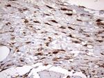 LGALS3 Antibody in Immunohistochemistry (Paraffin) (IHC (P))