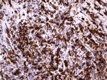 LGALS3 Antibody in Immunohistochemistry (Paraffin) (IHC (P))