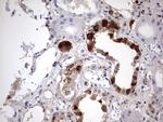 LGALS3 Antibody in Immunohistochemistry (Paraffin) (IHC (P))