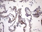 LGALS3 Antibody in Immunohistochemistry (Paraffin) (IHC (P))