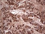 LGALS3 Antibody in Immunohistochemistry (Paraffin) (IHC (P))