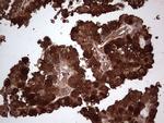 LGALS3 Antibody in Immunohistochemistry (Paraffin) (IHC (P))