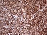 LGALS3 Antibody in Immunohistochemistry (Paraffin) (IHC (P))