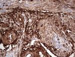 LGALS3 Antibody in Immunohistochemistry (Paraffin) (IHC (P))