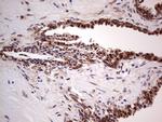 LGALS3 Antibody in Immunohistochemistry (Paraffin) (IHC (P))