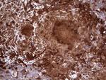 LGALS3 Antibody in Immunohistochemistry (Paraffin) (IHC (P))