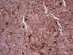 LGALS3 Antibody in Immunohistochemistry (Paraffin) (IHC (P))