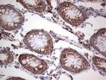 LGALS3 Antibody in Immunohistochemistry (Paraffin) (IHC (P))