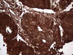 LGALS3 Antibody in Immunohistochemistry (Paraffin) (IHC (P))