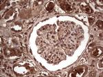 LGALS3 Antibody in Immunohistochemistry (Paraffin) (IHC (P))