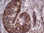 LGALS3 Antibody in Immunohistochemistry (Paraffin) (IHC (P))