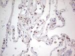 LGALS3 Antibody in Immunohistochemistry (Paraffin) (IHC (P))