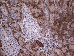 LGALS3 Antibody in Immunohistochemistry (Paraffin) (IHC (P))