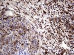 LGALS3 Antibody in Immunohistochemistry (Paraffin) (IHC (P))